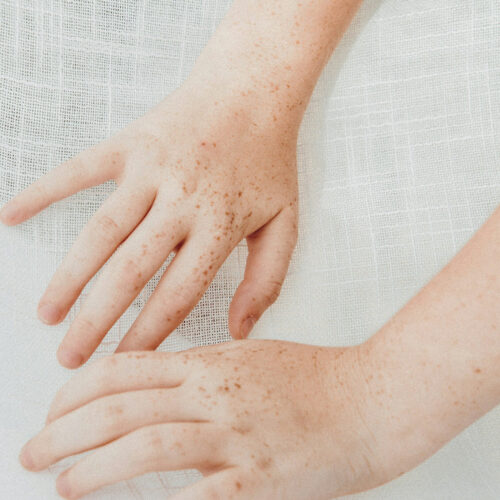 The GO-TO gentle cleanser your skin needs!